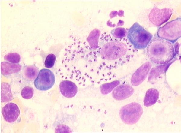 Leishmaniose / Leishmaniasis Bildserie 2